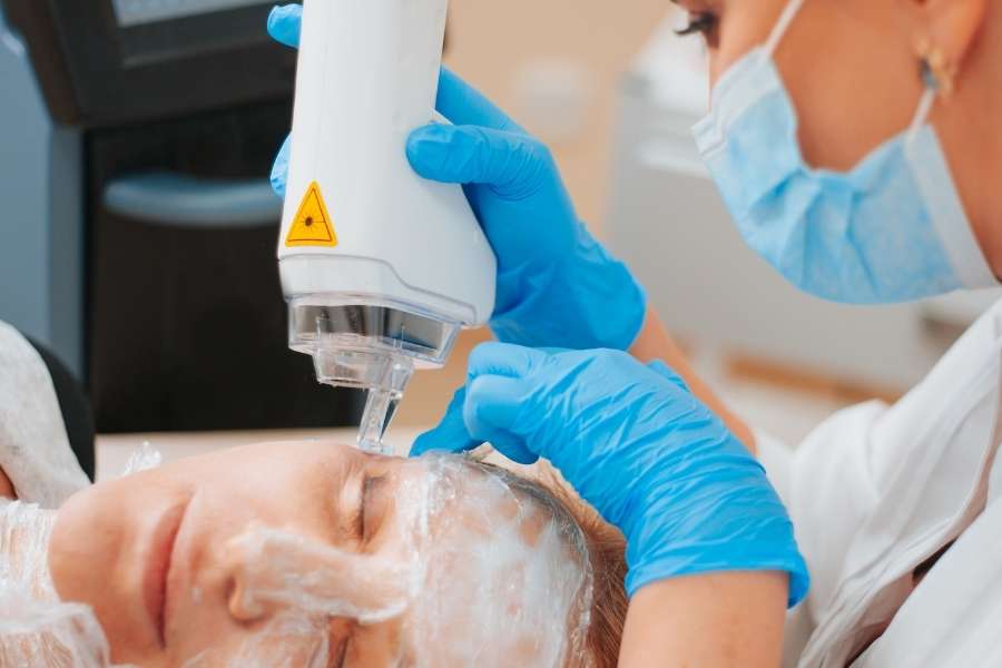 Praticienne gantée de bleu appliquant un appareil laser sur le front d'une patiente allongée dans un cabinet de médecine esthétique