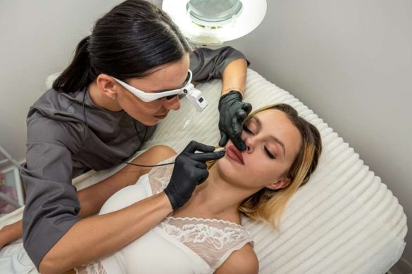 Praticienne en médecine esthétique avec lunettes loupe et gants noirs réalisant un soin sur les lèvres d'une patiente allongée en cabinet